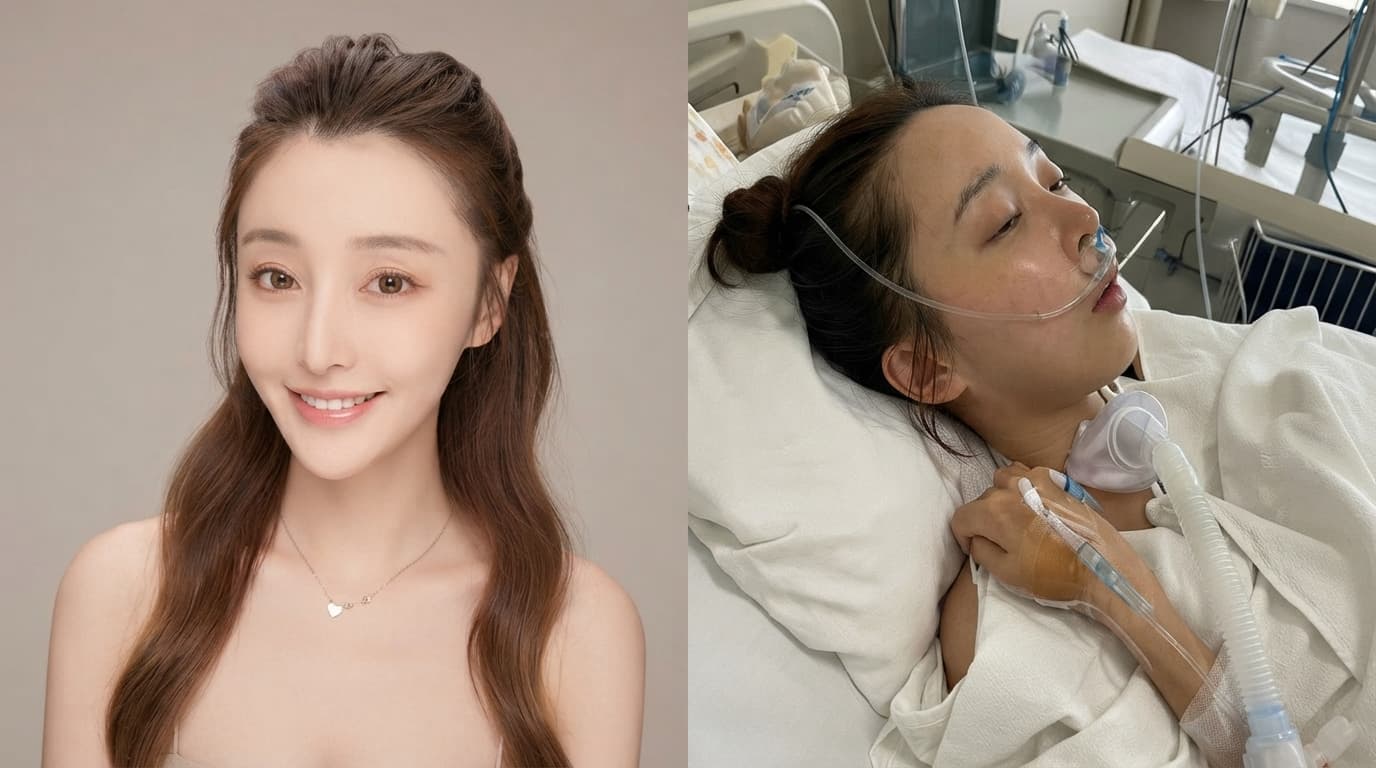 Kisah Perjuangan Artis China Kembali Syuting Setelah Sempat Koma Selama Tiga Bulan